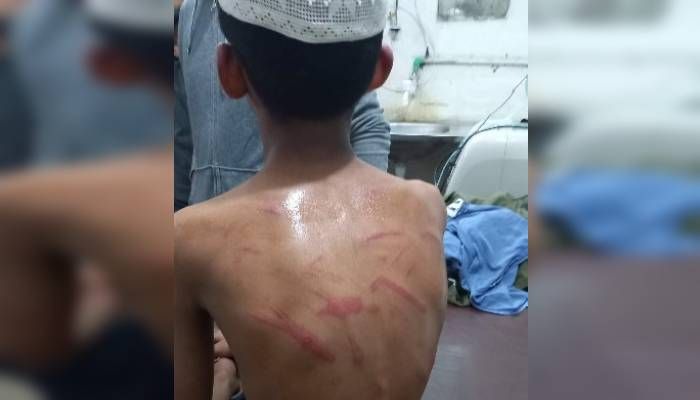 শিক্ষকের ‘পিটুনিতে’ হাসপাতালে মদ্রাসাছাত্র
