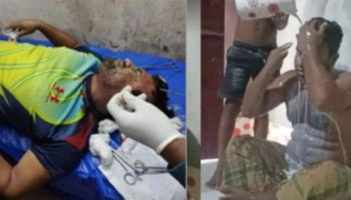 হামলায় আহত দুধ দিয়ে গোসল করা ছাত্রলীগ নেতা আরমিন। ছবি : প্রবা 