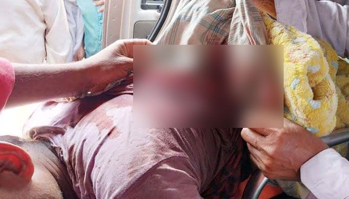 বাঘের থাবায় অনুকূলের মেরুদণ্ড, পাঁজরসহ পেটে ক্ষত সৃষ্টি হয়েছিল। প্রবা ফটো