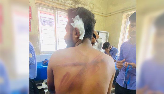 ফেনী পলিটেকনিকে ছাত্রলীগের সংঘর্ষে আহত ১০