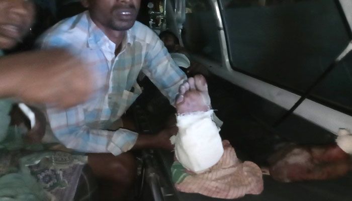 মর্টারশেলকে ‘গুপ্তধন’ ভেবে কাটতে গিয়ে বিস্ফোরণে গোড়ালি বিচ্ছিন্ন