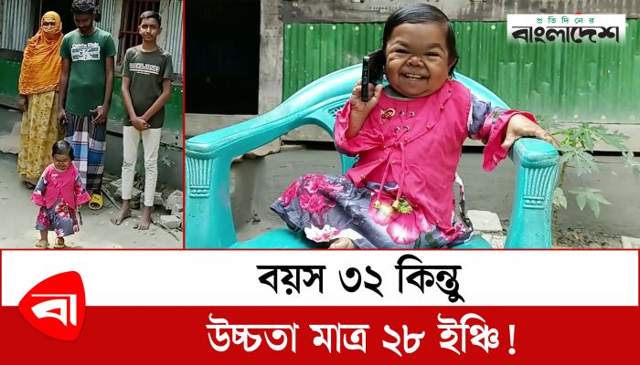 বয়স ৩২ কিন্তু উচ্চতা মাত্র ২৮ ইঞ্চি!