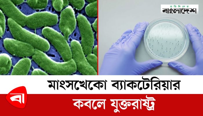 মাংসখেকো ব্যাকটেরিয়ার কবলে যুক্তরাষ্ট্র 