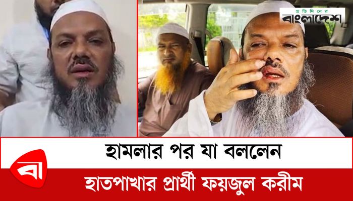 হামলার পর যা বললেন হাতপাখার প্রার্থী সৈয়দ ফয়জুল করীম