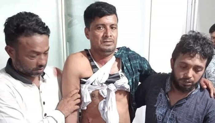 লাকসামে বিএনপির গাড়িবহরে হামলা, আহত ২০