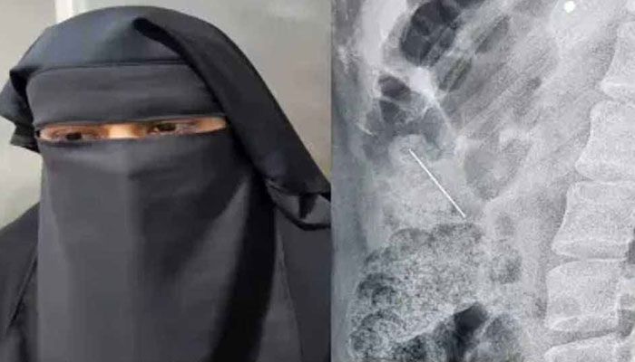 হিজাব পরার পিন গিলে ফেললেন শিক্ষার্থী