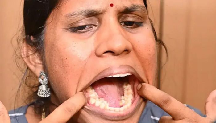 ৩৮ দাঁত নিয়ে রেকর্ড গড়লেন ভারতীয় নারী