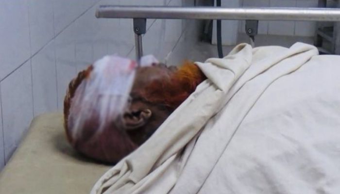 আশুলিয়ায় ডাকাতের সঙ্গে গোলাগুলি, নিরাপত্তাকর্মী নিহত