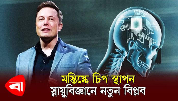 মস্তিষ্কে চিপ স্থাপন, স্নায়ুবিজ্ঞানে নতুন বিপ্লব