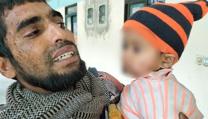 বরিশালে জেলে পরিবারে এসিড হামলায় শিশুসহ দগ্ধ ৩, গ্রেপ্তার ৪