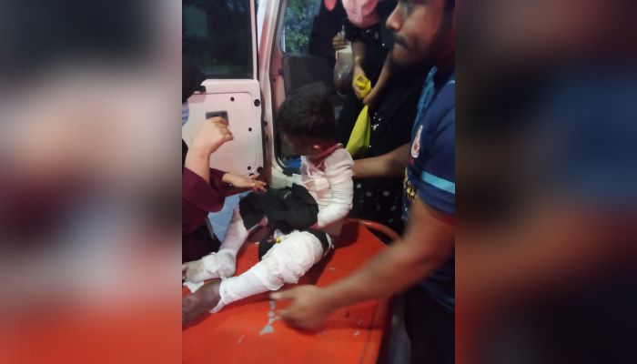 ভাসানচরে দগ্ধ আরও এক রোহিঙ্গা শিশুর মৃত্যু