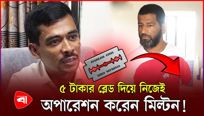 নার্স হয়ে মিল্টন নিজেই করেন অপারেশন!