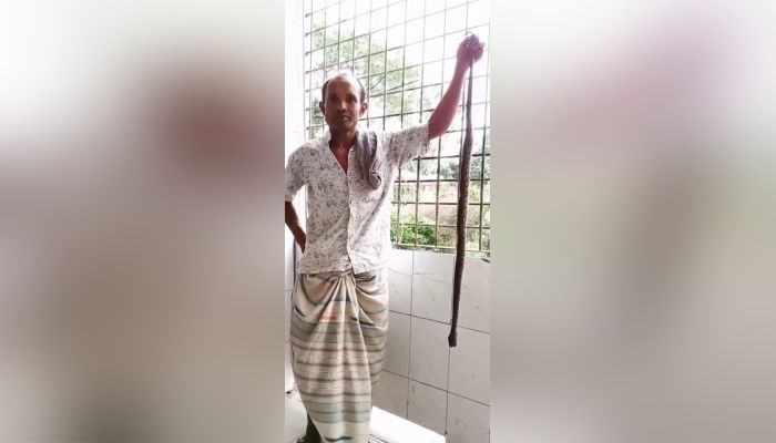ছোবলের পর হাতে সাপ নিয়ে হাসপাতালে