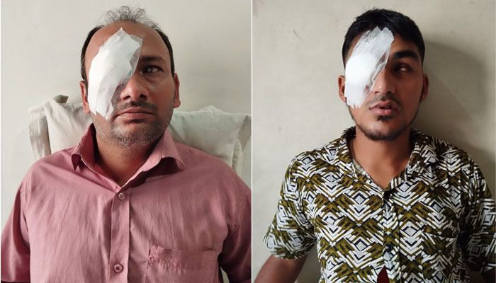 রনোর কর্নিয়ায় দৃষ্টিশক্তি পেলেন তারা
