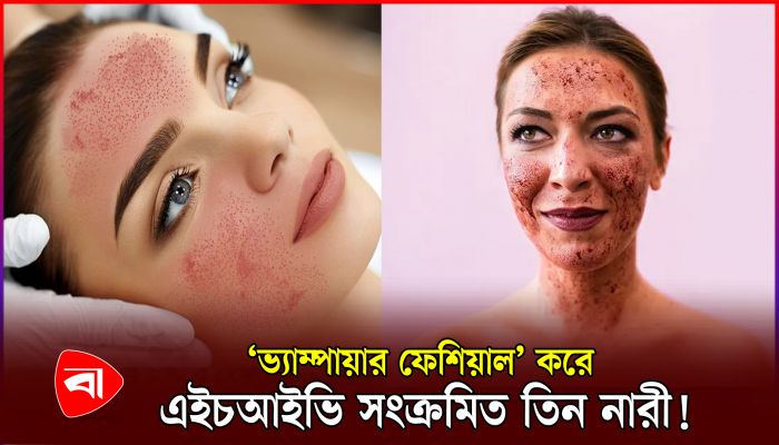ফেসিয়াল করাতে গিয়ে বিপত্তি, এইডস আক্রান্ত তিন নারী