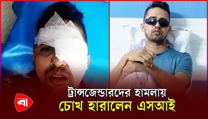 ট্রান্সজেন্ডারদের হামলায় চোখ হারালেন রমনা থানার এসআই 