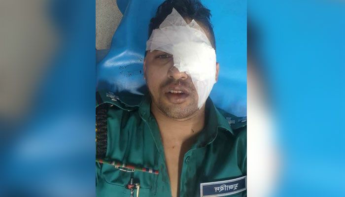 ট্রান্সজেন্ডারদের হামলায় রমনা থানার এসআইয়ের চোখে জখম