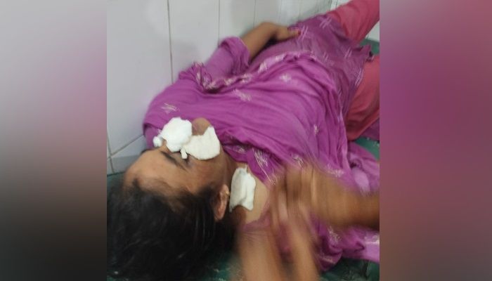 তালাক দেওয়ার জেরে স্ত্রীকে এসিড নিক্ষেপের অভিযোগ