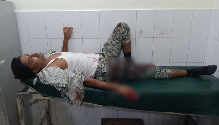 উখিয়ায় রোহিঙ্গা ক্যাম্পে সন্ত্রাসীদের গুলিতে এপিবিএন সদস্য আহত