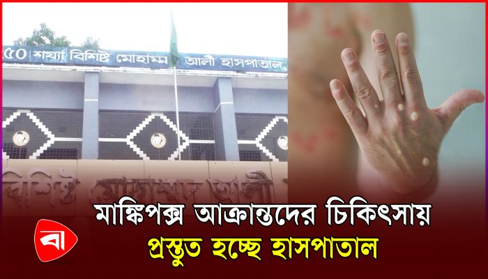 মাঙ্কিপক্স আক্রান্তদের চিকিৎসায় বগুড়ায় প্রস্তুত হচ্ছে আইসোলেশন ইউনিট