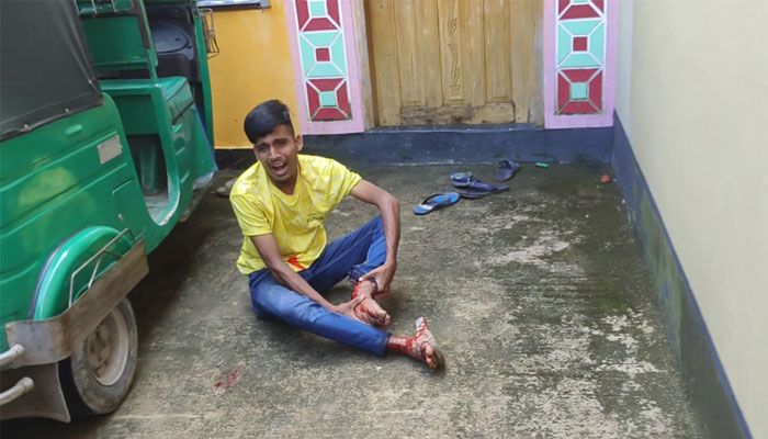 রিপন হাসপাতালে, জীবিকার কষ্টে অসহায় পরিবার