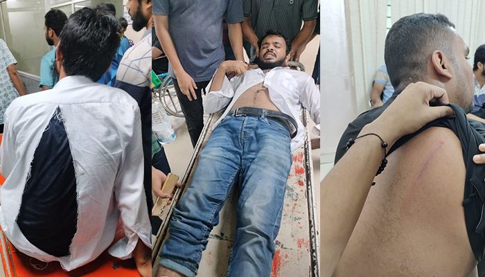 ছাত্রদলের ওপর ‘শিবিরের’ হামলা, ৫ নেতাকর্মী আহত