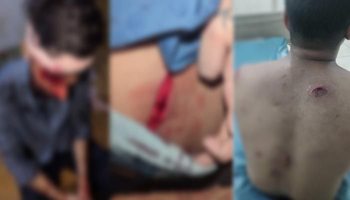 ৪ ছাত্রলীগ নেতাকে কুপিয়ে আহত