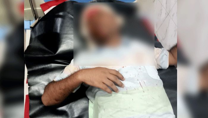 কোনাবাড়ীতে ঝুট ব্যবসার নিয়ন্ত্রণ নিয়ে বিএনপির দুই পক্ষের সংঘর্ষ