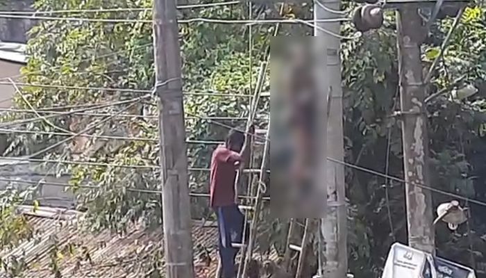 বৈদ্যুতিক তারে জড়িয়ে অগ্নিদগ্ধ 