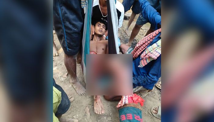 নাইক্ষংছড়িতে স্থলমাইন বিস্ফোরণে তরিকুল নামে এক কিশোর আহত। প্রবা ফটো