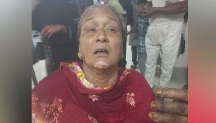 চট্টগ্রামে সিএনজিতে পেট্রোলবোমা নিক্ষেপ, দগ্ধ দুই নারী 