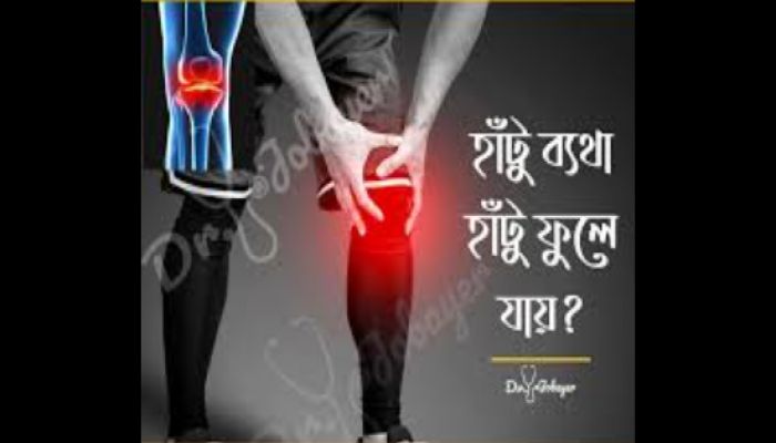 অস্টিও-আথ্রাইটিজ জনিত হাঁটু ব্যথার লক্ষণ ও করনীয়