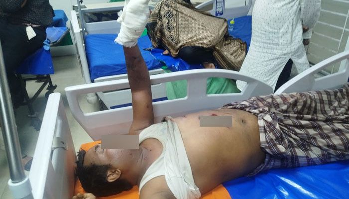 রাজধানীতে ছাদে বোমাসদৃশ বস্তু বিস্ফোরণ, কেয়ার টেকার আহত