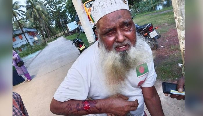 পুত্রবধূ ও স্বজনদের হামলায় হাসপাতালে বৃদ্ধ শ্বশুর