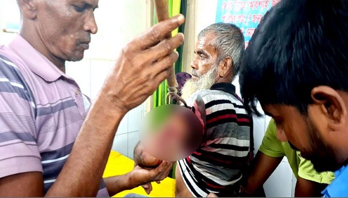 আড়াইহাজারে বাড়ি দখল নিয়ে তিন গ্রামবাসীর সংষর্ষ, আহত ২০