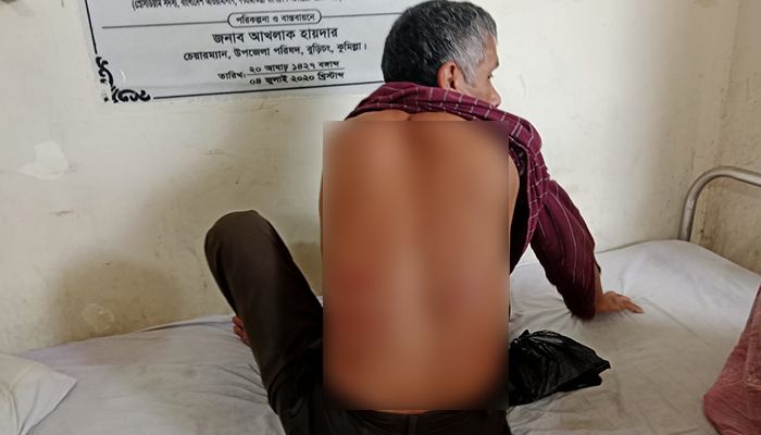 বৃদ্ধ পাহারাদারকে পিটিয়ে আহত করলেন যুবদল নেতা