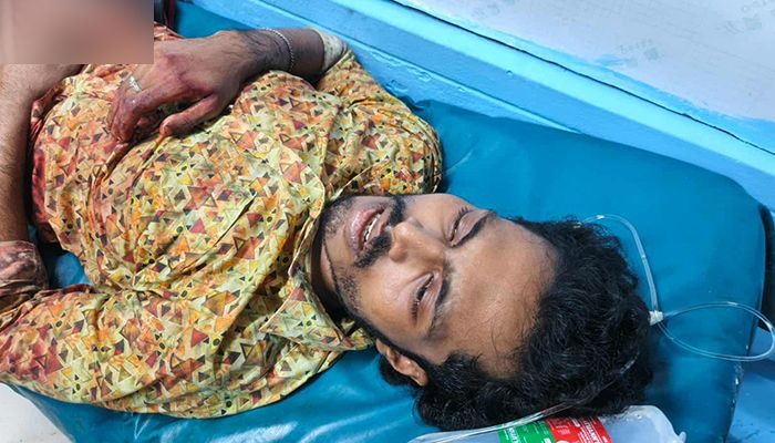 খুলনায় রেজিস্ট্রি অফিসের সামনে গুলি, যুবক আহত