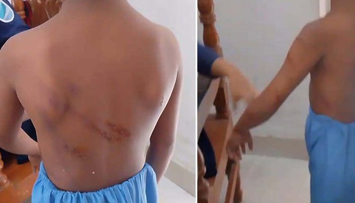 শরীর ম্যাসেজ না করায় মাদ্রাসা ছাত্রকে নির্যাতন