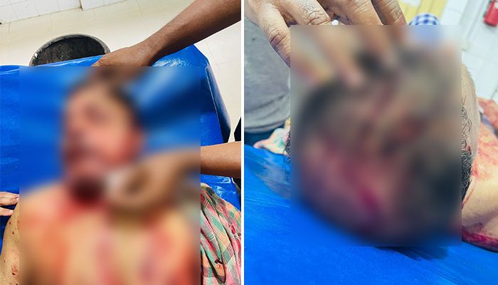 ব্যবসায়ীকে হাতুরিপেটা করে স্বর্ণালংকার ও টাকা লুট