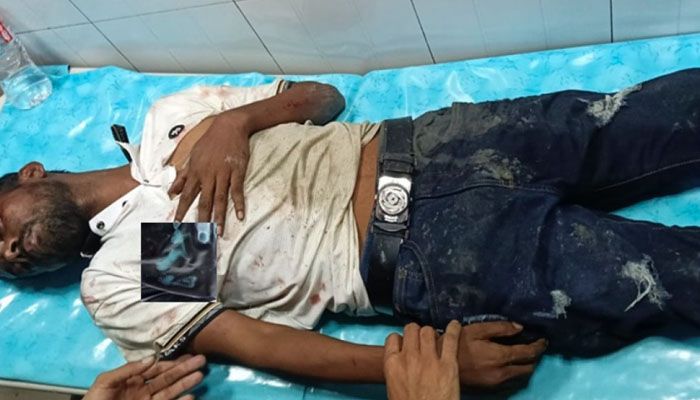 আফতাবনগরে হিরো আলমের ওপর হামলা