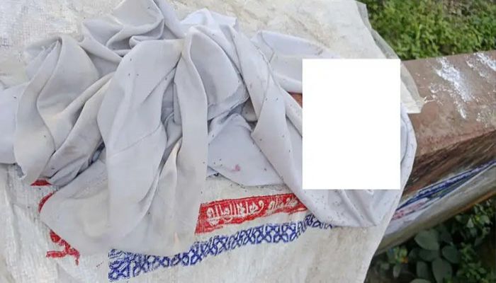 তেরখাদায় প্লাস্টিকের বস্তায় নবজাতকের মরদেহ