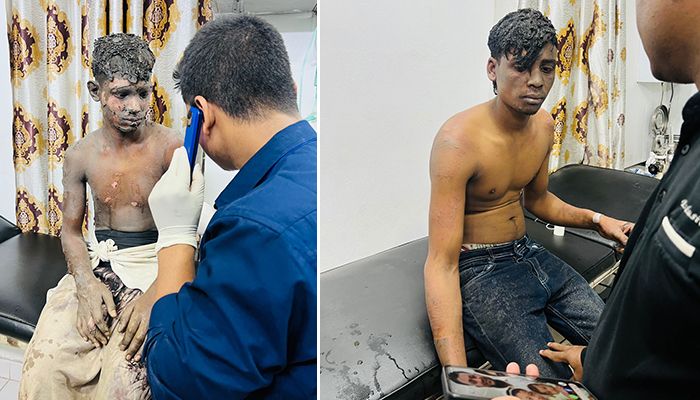প্লাস্টিক কারখানায় মেশিন বিস্ফোরণ, দুই শ্রমিক দগ্ধ