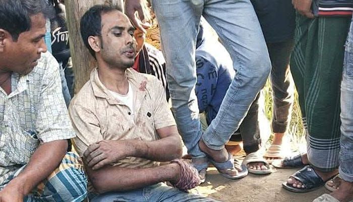 চোর সন্দেহে যুবদল নেতাকে ধাওয়া, গণপিটুনিতে ভেঙে গেল পা