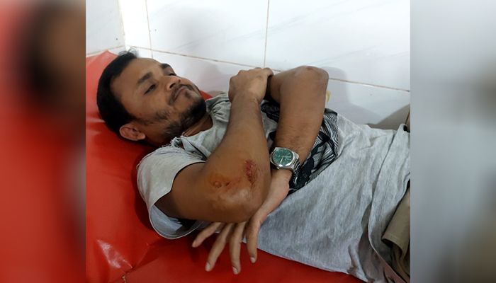 ছাত্রদল নেতা ও শিক্ষকসহ তিনজনকে পিটিয়ে আহত
