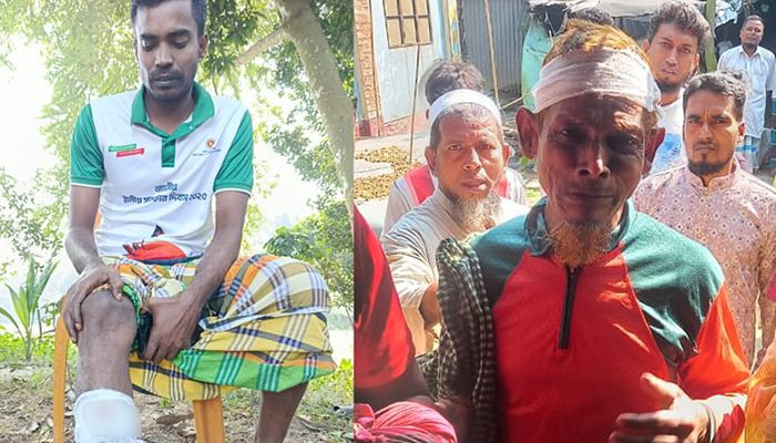 আড়াইহাজারে আওয়ামী লীগ-বিএনপি সংঘর্ষ-ককটেল বিস্ফোরণ, আহত ১৫