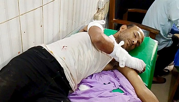 দুর্গাপুরে সংবাদ সংগ্রহে গিয়ে দুর্বৃত্তদের হামলায় সাংবাদিক আহত