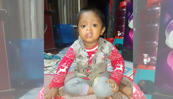 গরম পানিতে পড়ে দগ্ধ শিশুর চিকিৎসায় শেষ সম্বল বিক্রি, চাকরিচ্যুত মা