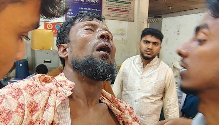 হাদির জন্য দোয়া করায় মসজিদে আওয়ামী নেতাদের হট্টগোল-মারামারি, শ্রমিক নেতা আহত