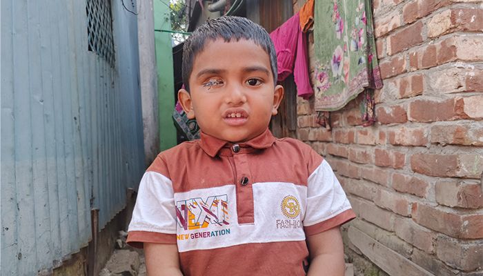 ক্যান্সার আক্রান্ত শিশুকে বাঁচাতে দিশেহারা মা, খোঁজ নেননা বাবা 