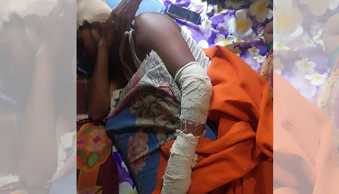 ডাকাতির ঘটনায় আহত পাওয়ার লুমের শ্রমিক আব্দুল। প্রবা ফটো